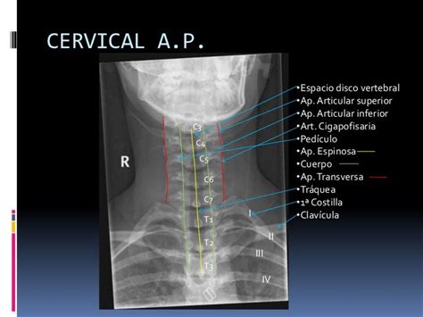 Manual rx columna vertebral Imagenes de medicos Radiología Columnas