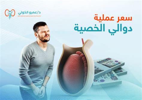 سعر عملية دوالي الخصية مع افضل دكتور علاج الدوالي في مصر