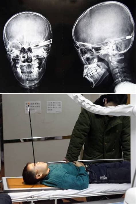Craziest X Ray Images Heavy Com