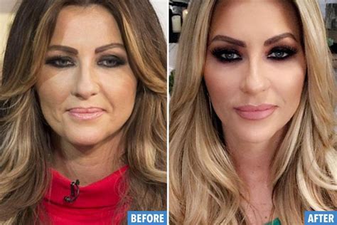 Real Housewives Of Cheshire Star Dawn Ward Reveals Her Amazing Wrinkle Free Look After Full