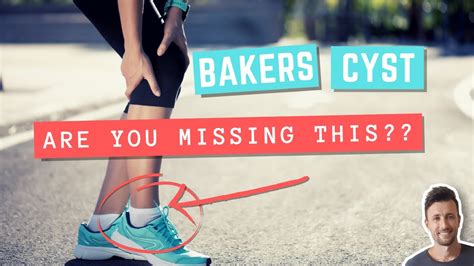 Bakers Cyst Exercises You Probably Arent Doing But Absolutely Should