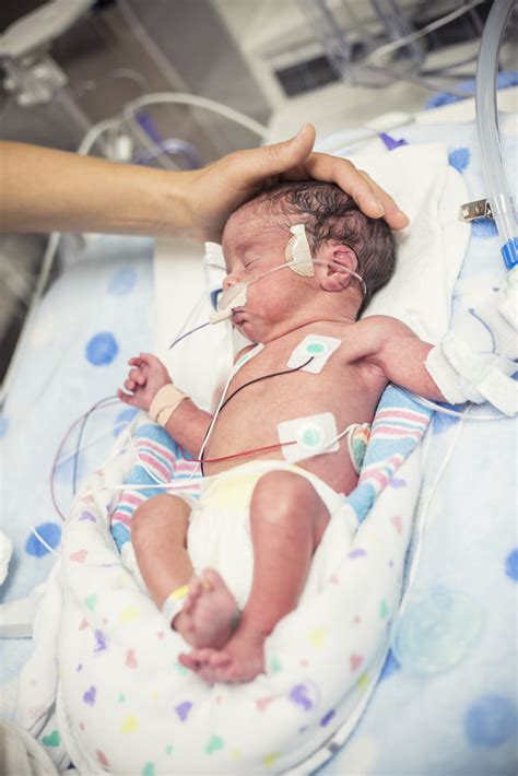 The Challenges Of Preterm Infant Formula Development Astarte Medical