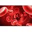 Microcytic Anemia  Causes Symptoms Treatment
