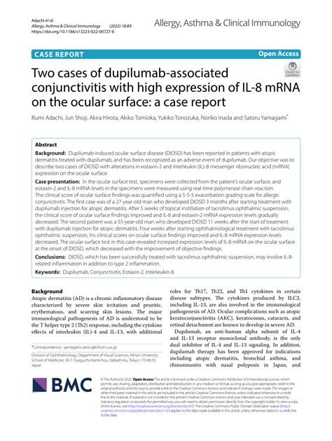 Pdf Two Cases Of Dupilumab Associated Conjunctivitis With High