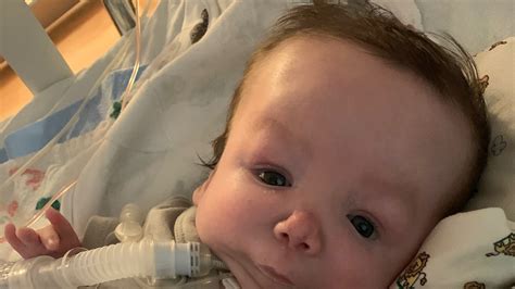 Home For The Holidays Baby Born With Rare Genetic Disorder