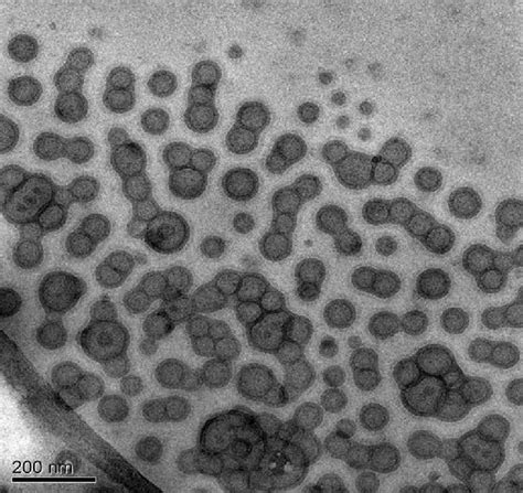 Tem Micrograph Of P2 Vesicles Prepared As Described In Fig 3