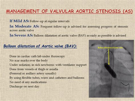 Management Of Valvular Aortic Stenosis As Dr Gaurav Agrawal