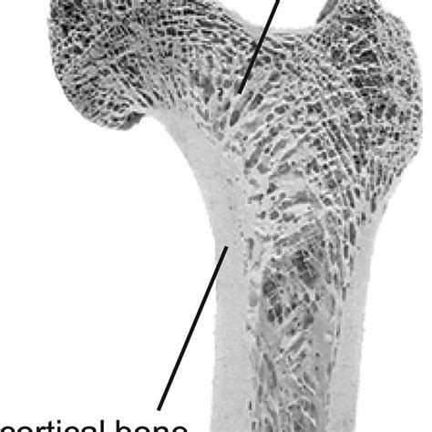Cortical And Cancellous Bone