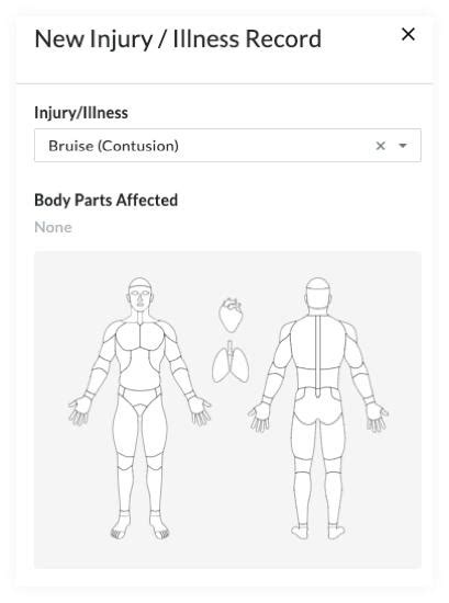 Incidents Body Diagram Added To Body Parts Affected Menu Procore