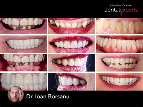 Culoarea în Stomatologie Clinica Dentară Prof Dr Bratu