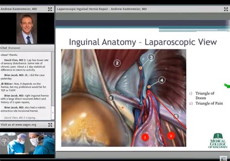 Laparoscopic Inguinal Hernia Repair Anatomy Anatomy Structure The