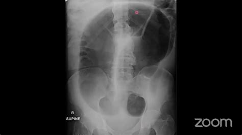 A Structured Approach Common Cases And Pitfalls To Abdominal And