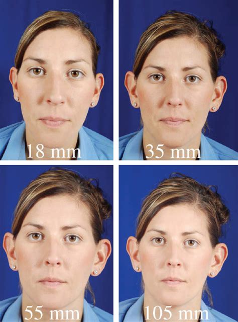 9 Photography In Facial Plastic Surgery Plastic Surgery Key