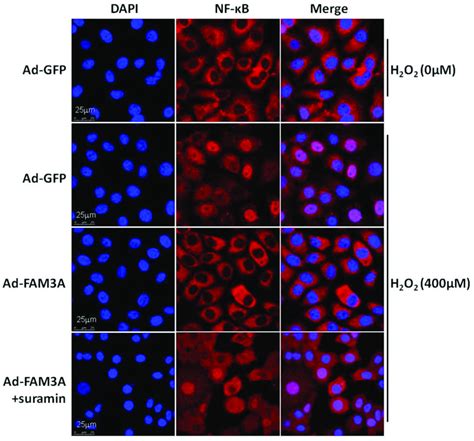Fam3a Inhibited Nf κb Activation Induced By Oxidative Stress In Hepg2