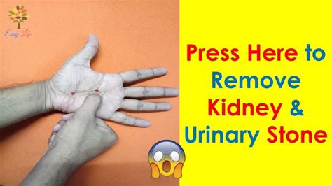 2 Acupressure Point For Kidney Stone And Urinary Bladder Stone With