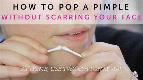 How To Pop A Pimple Without Scarring Your Face Youtube