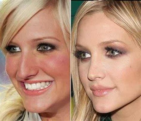 Ashlee Simpson Is Listed Or Ranked 2 On The List Celebrity Nose Jobs