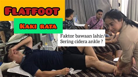 Telapak Kaki Rata Flatfoot Itu Cepet Pegel Bisa Di Fisioterapi