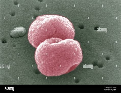 Photomicrograph Of Streptococcus Pneumoniae Bacteria Hi Res Stock