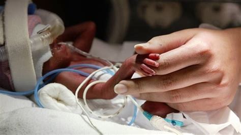 Bebé Recién Nacido Falleció En La Morgue Luego De Ser Declarado Muerto
