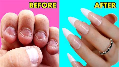 How To GROW Long Strong Nails Fast At Home DIY Making Nails Strengthener Serum With Home
