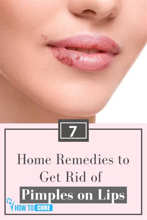7 Homeremedies To Get Rid Of Pimples On Lips Howtocure How To Get
