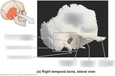 Temporal Bone Diagram Quizlet