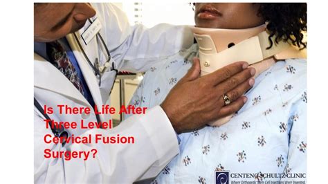 9 Complications After Three Level Cervical Fusion Surgery