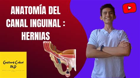 Hernia Inguinal Directa E Indirecta Anatom A D Youtube