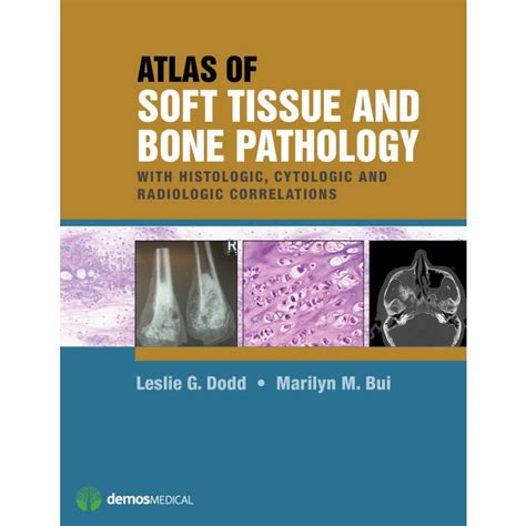 Atlas Of Soft Tissue And Bone Pathology