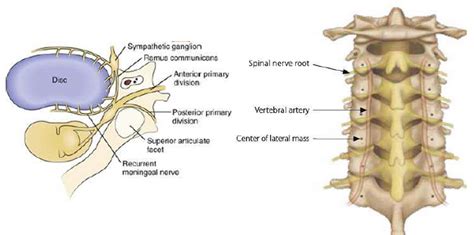 Lateral Mass Screws Fixation Of Cervical Spine موقع الاستاذ الدكتور