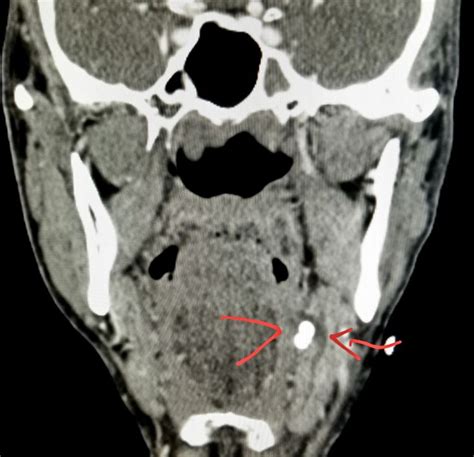 Pin On Ct Scans