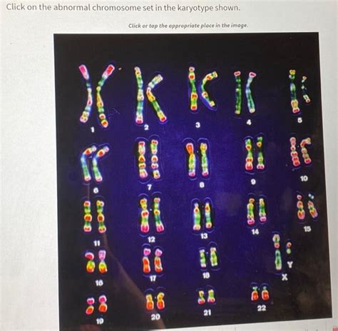 Solved Click On The Abnormal Chromosome Set In The Karyotype Chegg Com