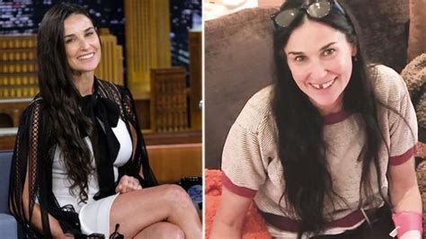 Demi Moore Lost Two Teeth To Stress 7 Signs Youre Way Too Stressed