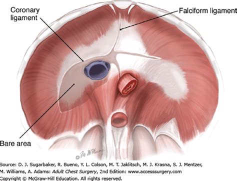 Incision Resection And Replacement Of The Diaphragm Thoracic Key