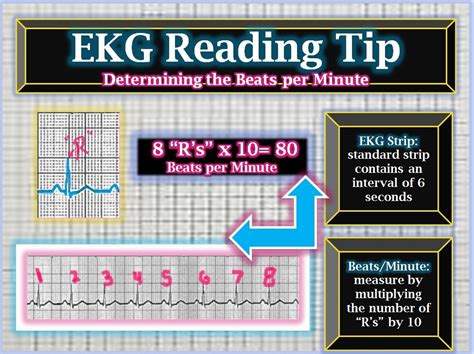 Ekg Reading Tips Beats Per Minute Via Box Counting On The Strip