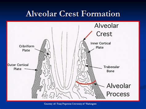Alveolar Bone Proper Cortical Plates