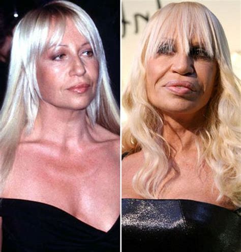Celebrity Plastic Surgery Donatella Versace Pamper My