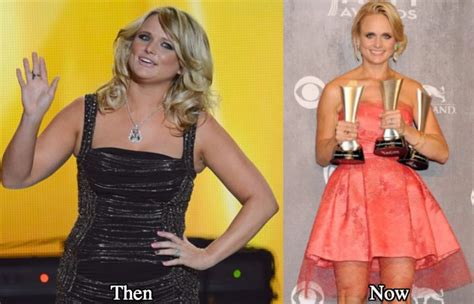 Miranda Lambert Plastic Surgery And Weight Loss Before And After Photos