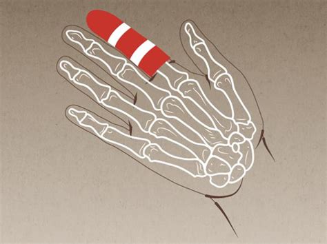 Così si capisce se c'è una frattura alla mano - Corriere.it