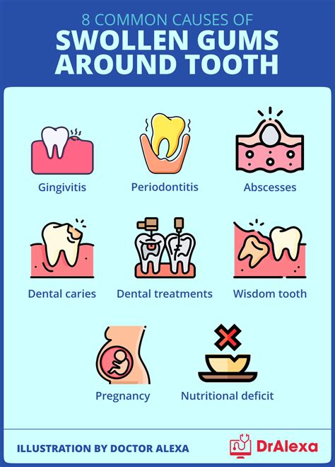 Swollen Gums Around Tooth Causes And Treatment Options
