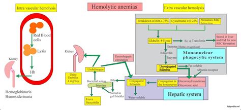 Anemia - Part 2 - Hemolytic Anemias, Causes and Lab ...