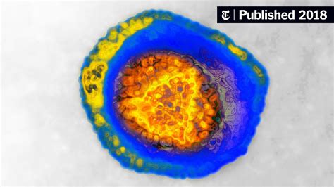 So if you were just diagnosed, even though your initial reaction may be to hide inside and how do you contract hsv 1? Herpes Is Slowly Retreating, but the Infection Remains ...