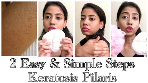 How To Get Rid Of Chicken Skin With Natural Remedy Keratosis Pilaris
