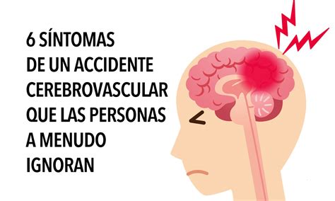 S Ntomas De Un Accidente Cerebrovascular Que Las Personas A Menudo