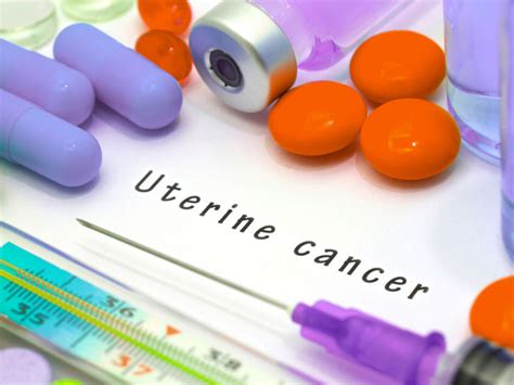 Mehdi kebria, a gynecologic oncologist at. Signs And Symptoms Of Uterine Cancer - Boldsky.com