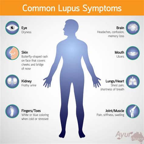 Ayurvedic Treatment For Lupus Ayur Healthcare