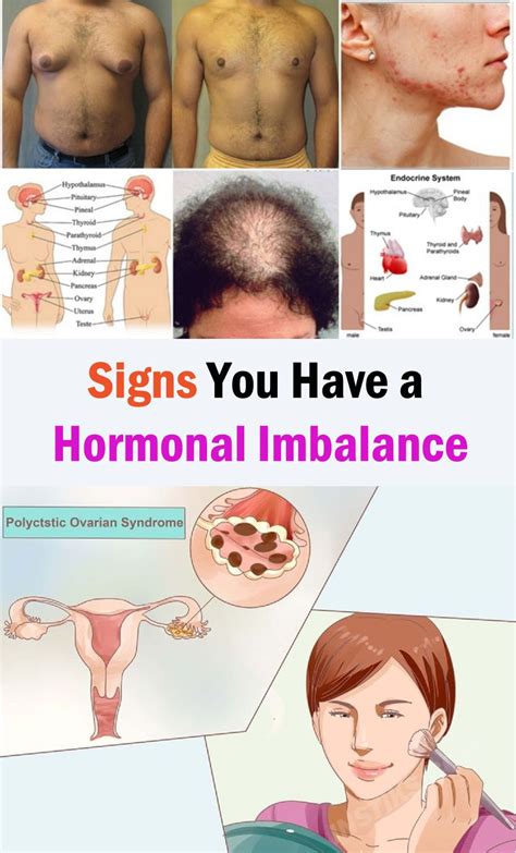 Signs You Have A Hormonal Imbalance And How To Correct It Hormone Imbalance Hormones Endocrine