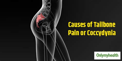 Are You Struggling With Tailbone Pain Know How It Is Caused