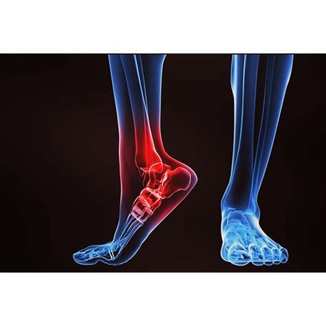 (from schuenke m, schulte e fig. The 19 Muscles Of The Foot : Foot Pain And Problems Johns Hopkins Medicine : Descriptive anatomy ...
